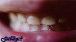 آیا همه چیز را راجع به دهان میدانید؟